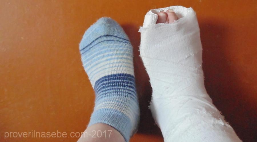 Liječenje edema nogu kod kuće