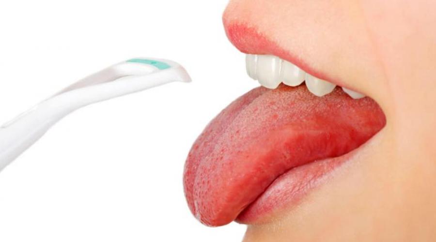 Как и зачем чистить язык? Рассказывает стоматолог. Зачем чистят язык