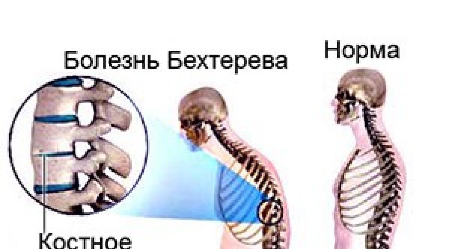 zgnječenje boli u zglobovima nego liječenje)